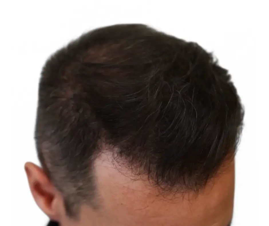 After image alt