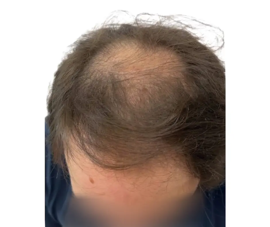Before image alt