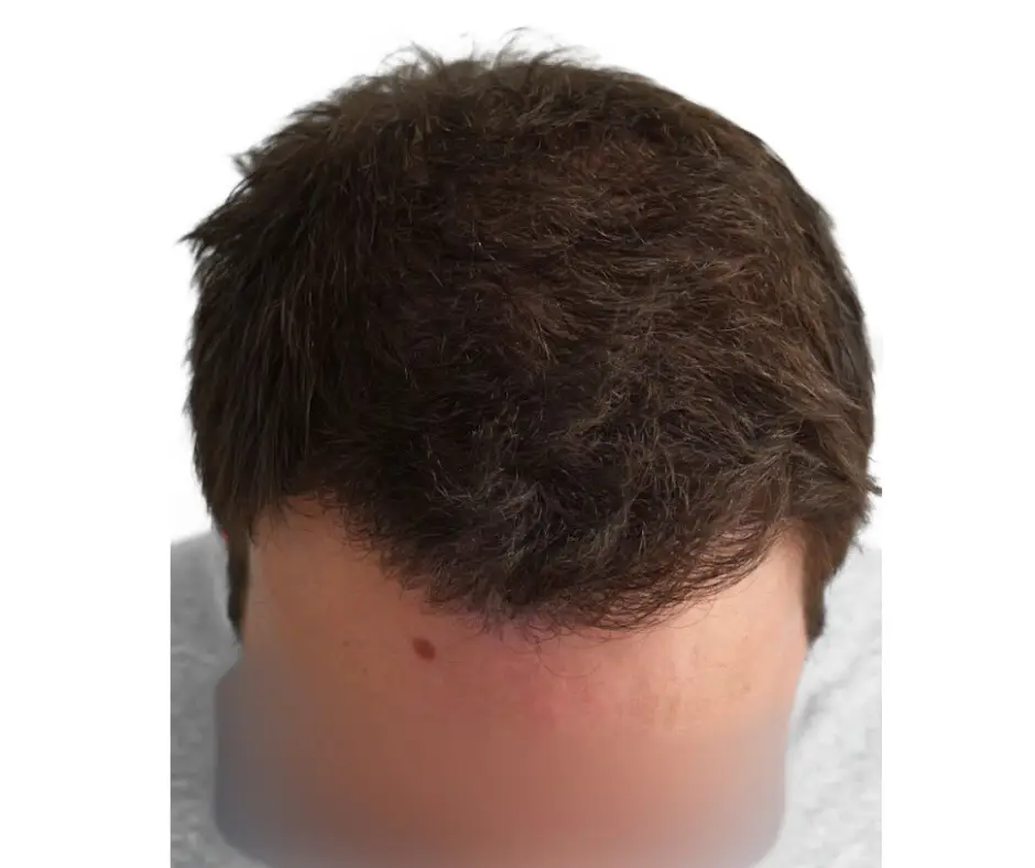 After image alt