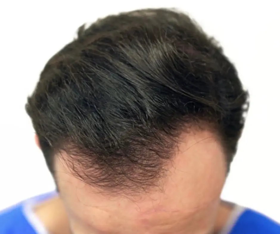 Before image alt