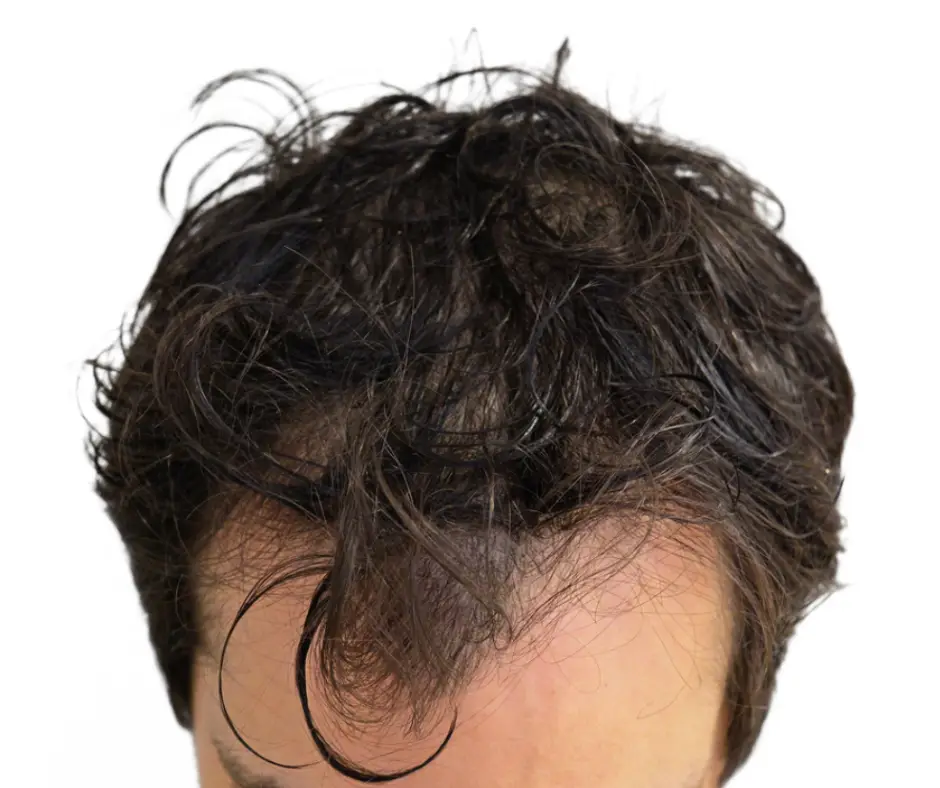 Before image alt