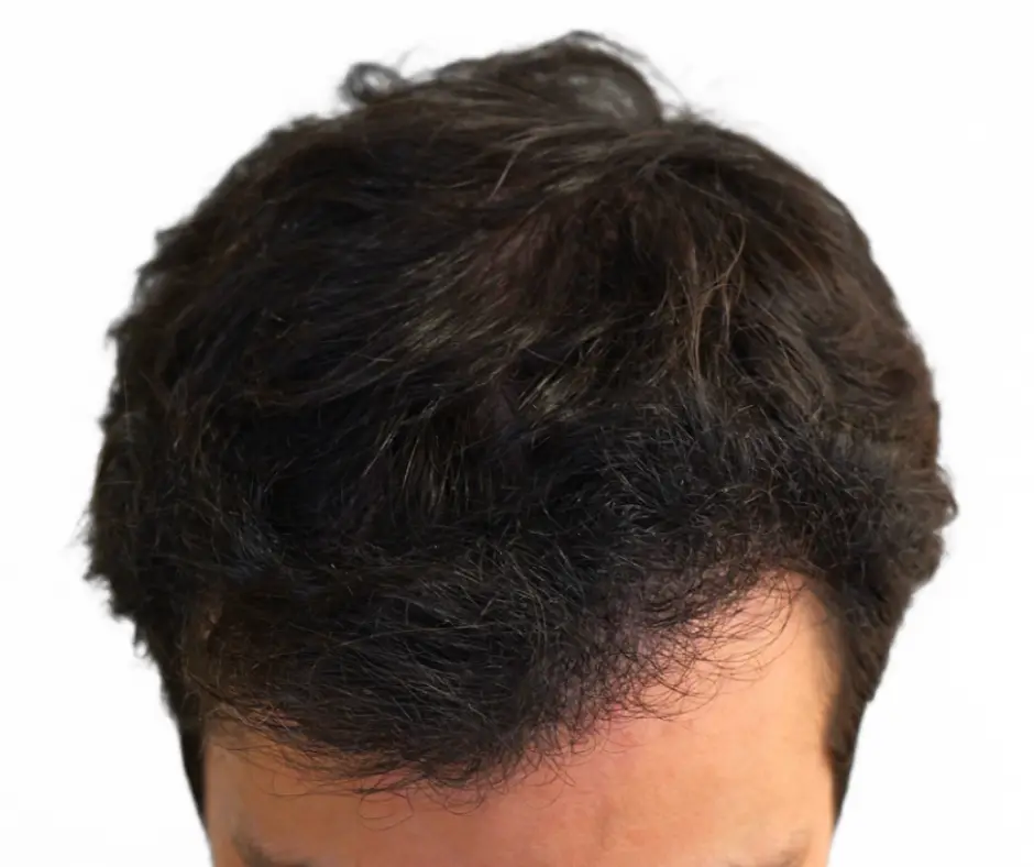 After image alt