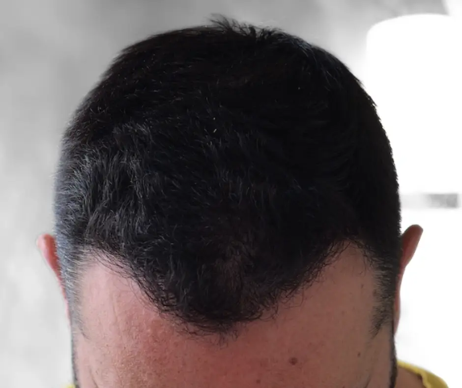 After image alt