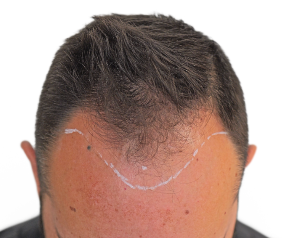 Before image alt